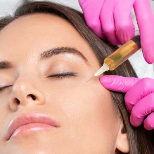 Antiaging 4 sessions PRP at Ana Aesthetic & Beauty in Freeport, NY